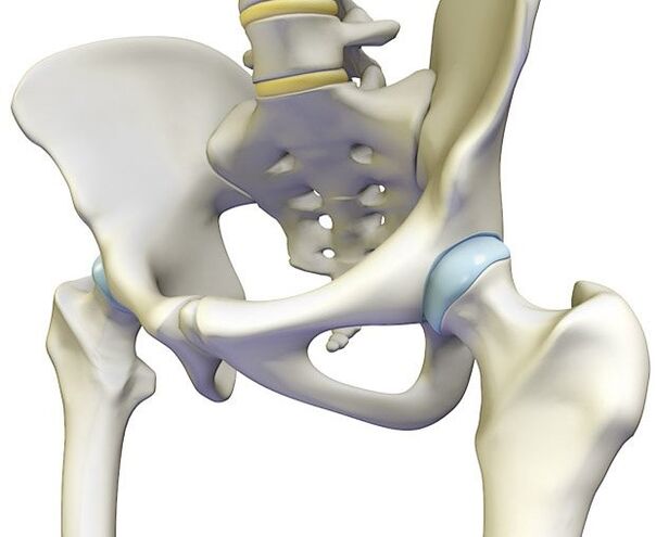 L'ostéochondrose provoque une douleur intense dans l'articulation de la hanche